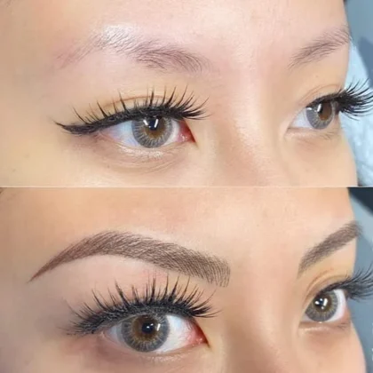 Schon Aesthetic Clinic Birmingham – Skin Care & Cosmetic Clinic