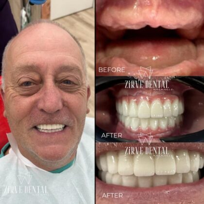 Zirve Dental Marmaris