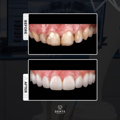 Dente Dental Studio