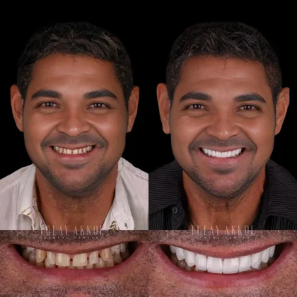 Tülay Akkol Dental Center