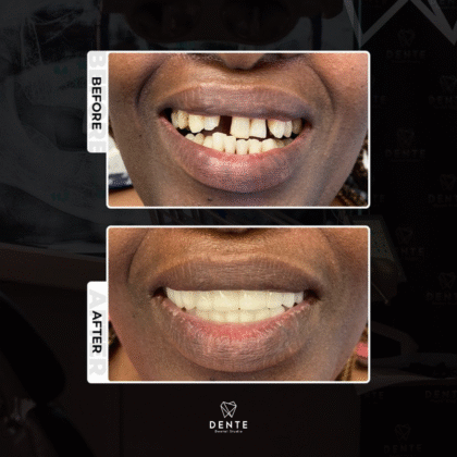 Dente Dental Studio