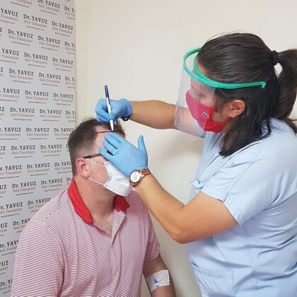 Dr. Ziya Yavuz Hair Transplant Clinic