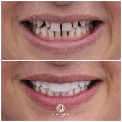 Inter Dental Turkey