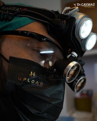 Hair Upload Hair Transplant Clinic