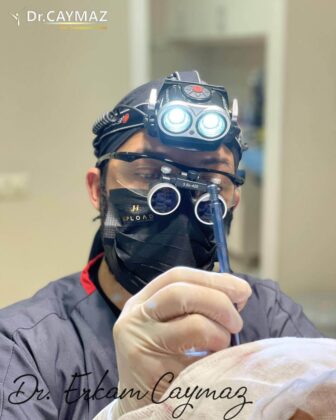 Hair Upload Hair Transplant Clinic