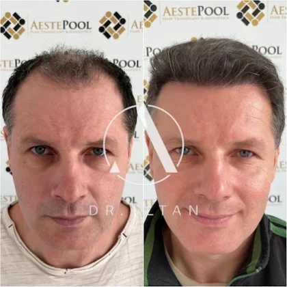 Aestepool Clinic