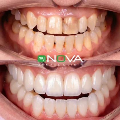 My Nova Kuşadası Dental Clinic