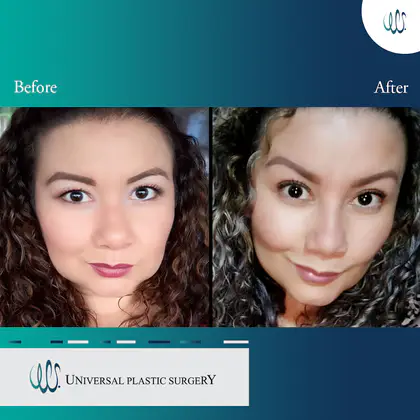 Universal Plastic Surgery Universal Plastic Surgery