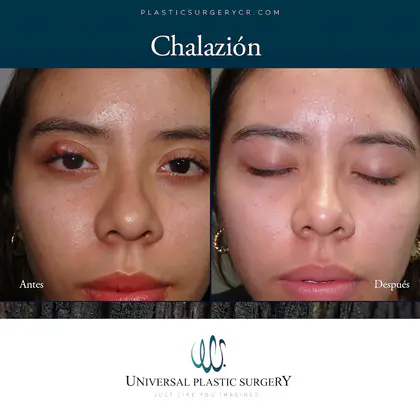 Universal Plastic Surgery Universal Plastic Surgery