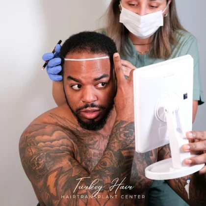 Turkey Hair Transplant Center Turkey Hair Transplant Center