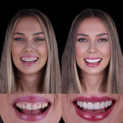 Tülay Akkol Dental Center