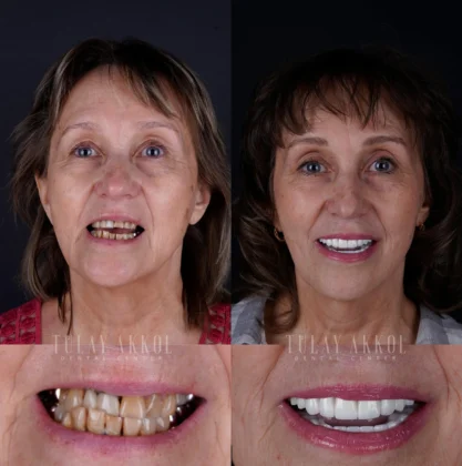 Tülay Akkol Dental Center