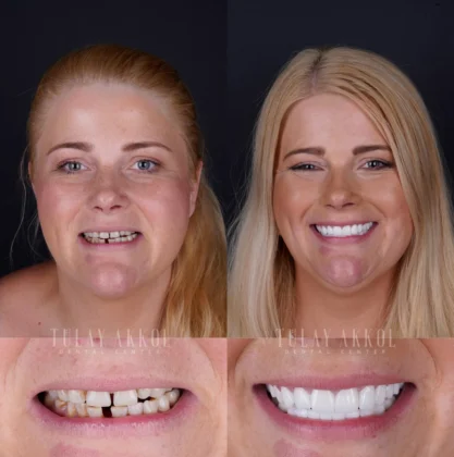 Tülay Akkol Dental Center