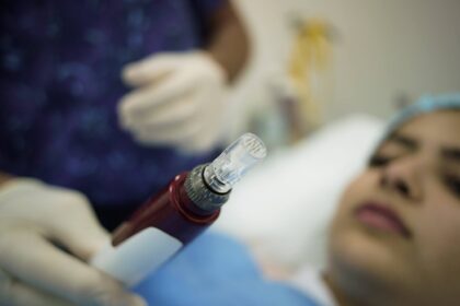 LCAS- London Centre for Aesthetic Surgery