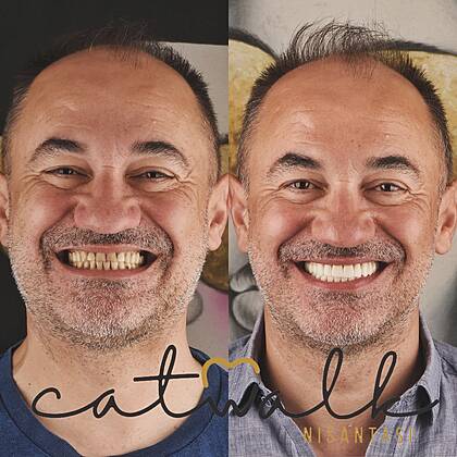 Catwalk Nişantaşı Dental Clinic