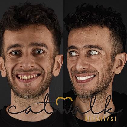 Catwalk Nişantaşı Dental Clinic