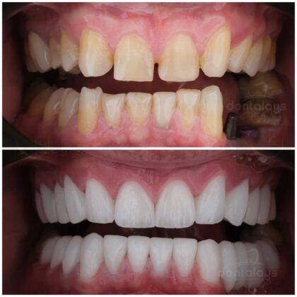 Dentalays Clinic Turkey
