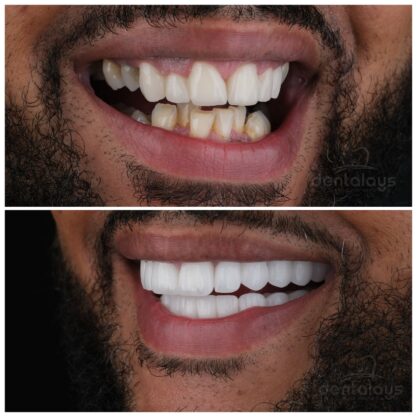 Dentalays Clinic Turkey