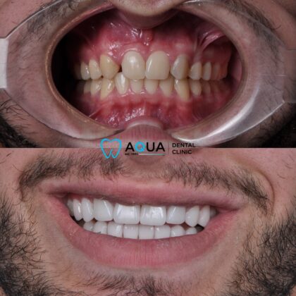 Aqua Dental Clinic