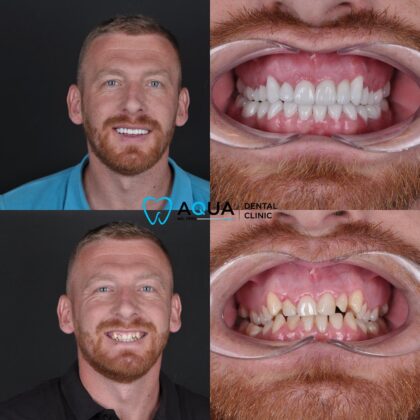 Aqua Dental Clinic