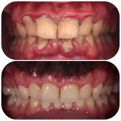 DentaVina Dental Clinic
