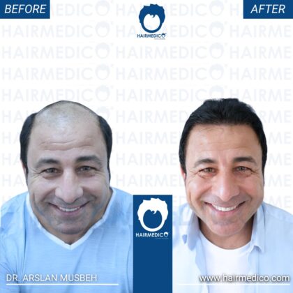 Hairmedico