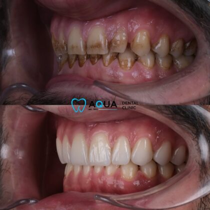 Aqua Dental Clinic