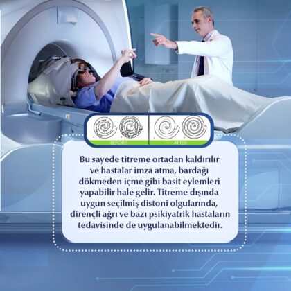 Medipol University Parkinson’s and Movement Disorders Center (PARMER)
