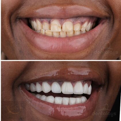 Dentalays Clinic Turkey