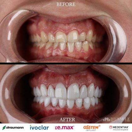 Biusmile Clinic