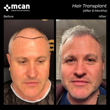 MCAN Health