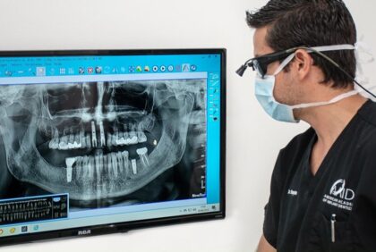 Dental Implants Costa Rica