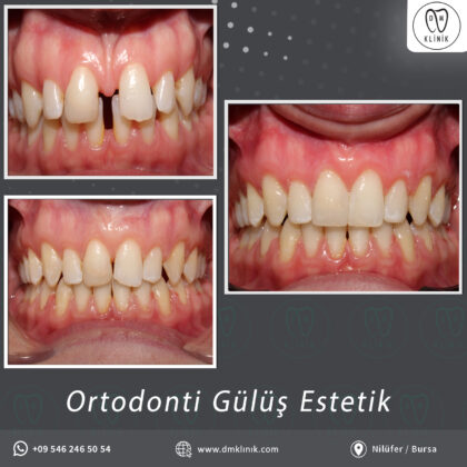 DM Klinik