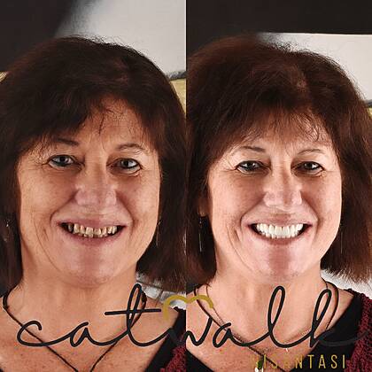 Catwalk Nişantaşı Dental Clinic