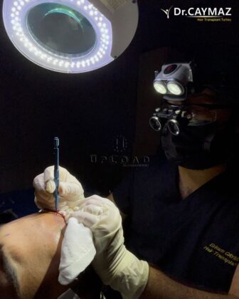 Hair Upload Hair Transplant Clinic