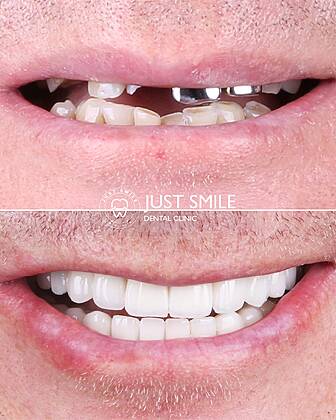 Just Smile Dental Clinic