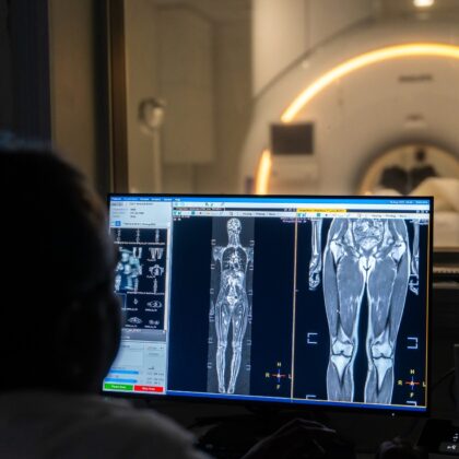 Artemis Hospital Gurgaon