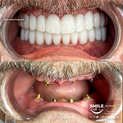 Yalova Dental Park
