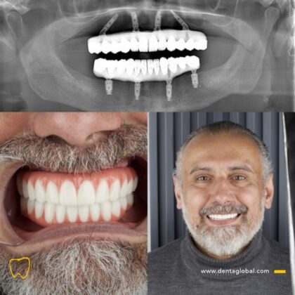 DENTAGLOBAL Dental Clinic