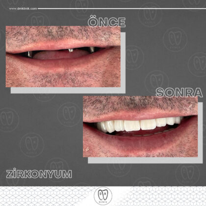 DM Klinik