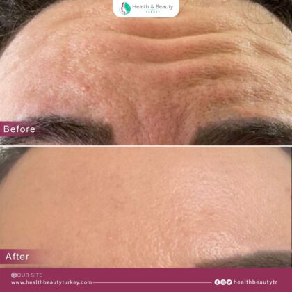 Health & Beauty Turkey Clinic