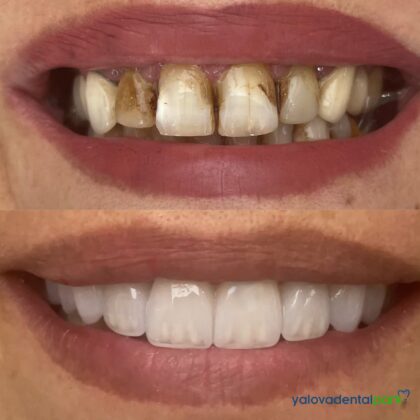 Yalova Dental Park