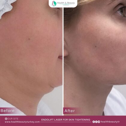 Health & Beauty Turkey Clinic