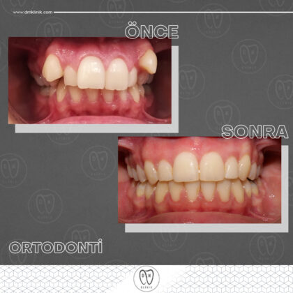 DM Klinik