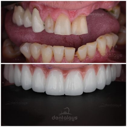 Dentalays Clinic Turkey