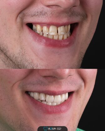 Aqua Dental Clinic
