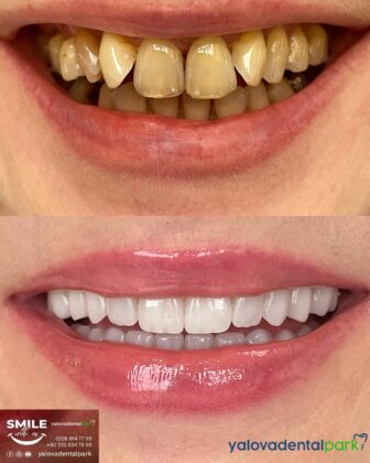 Yalova Dental Park