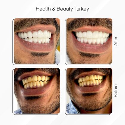 Health & Beauty Turkey Clinic