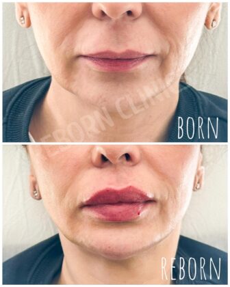 Reborn Clinics