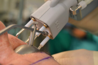 Antiaging Group Barcelona